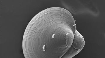 Electron micrograph of larval Crassostrea virginica oyster